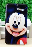 Capa Mickey para Samsung Galaxy Note2 N7100